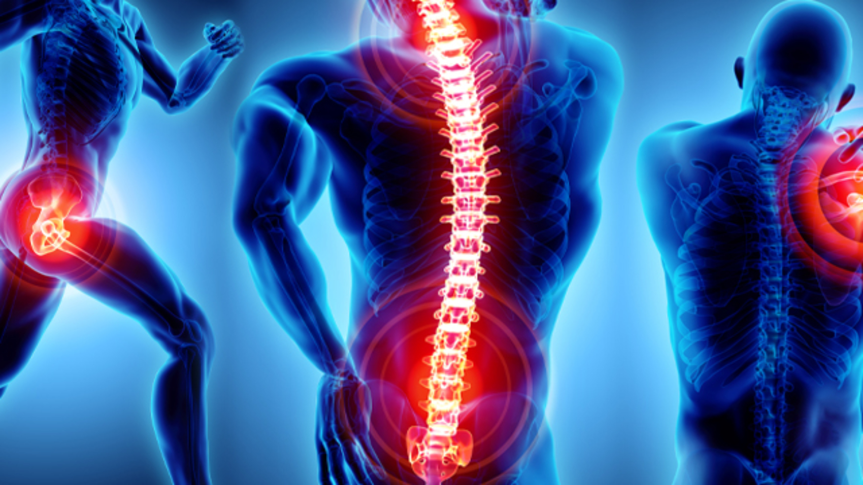 pmc_cover_pain_targets