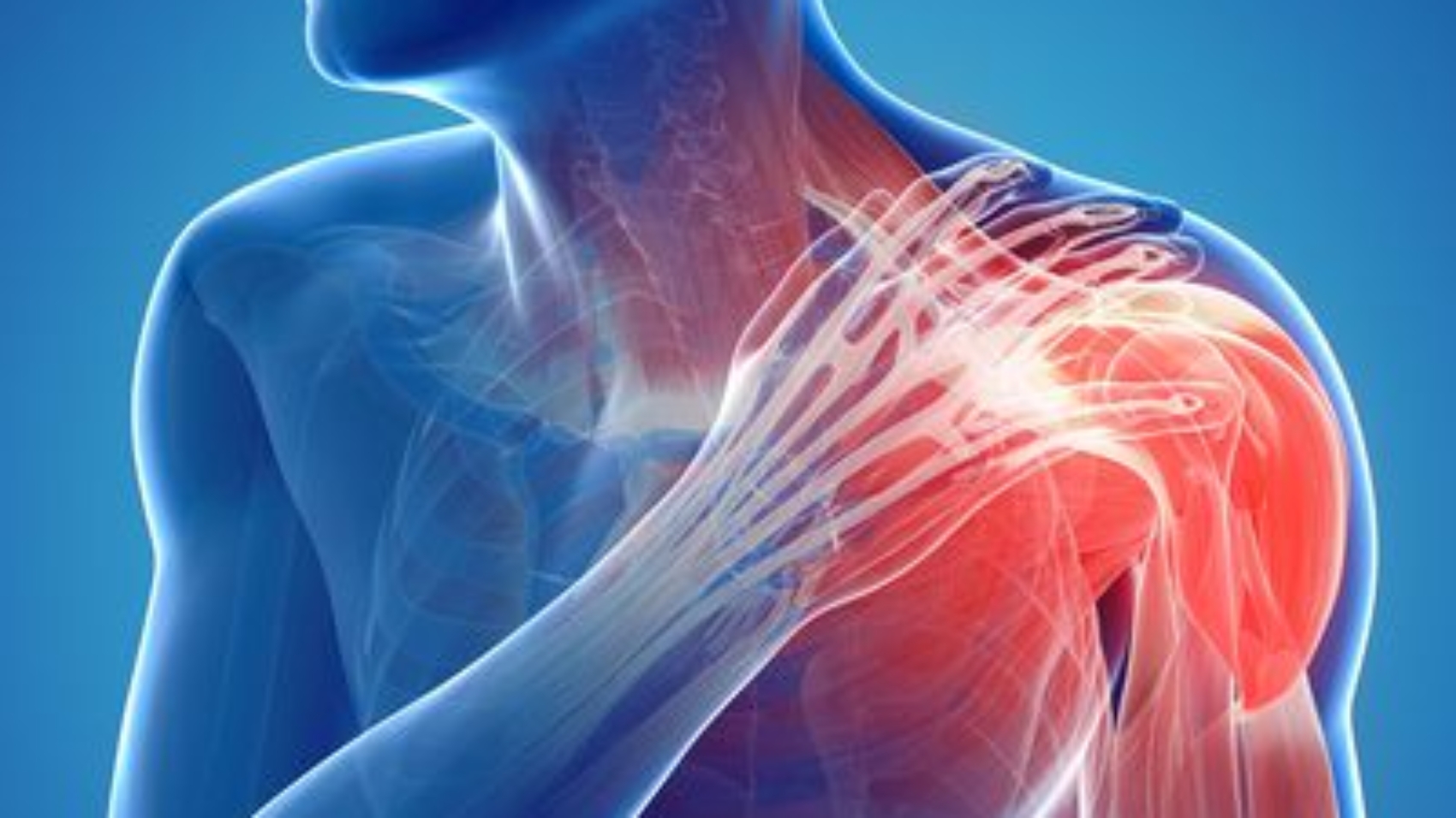 shoulder-pain-56a82a0b3df78cf7729cb497