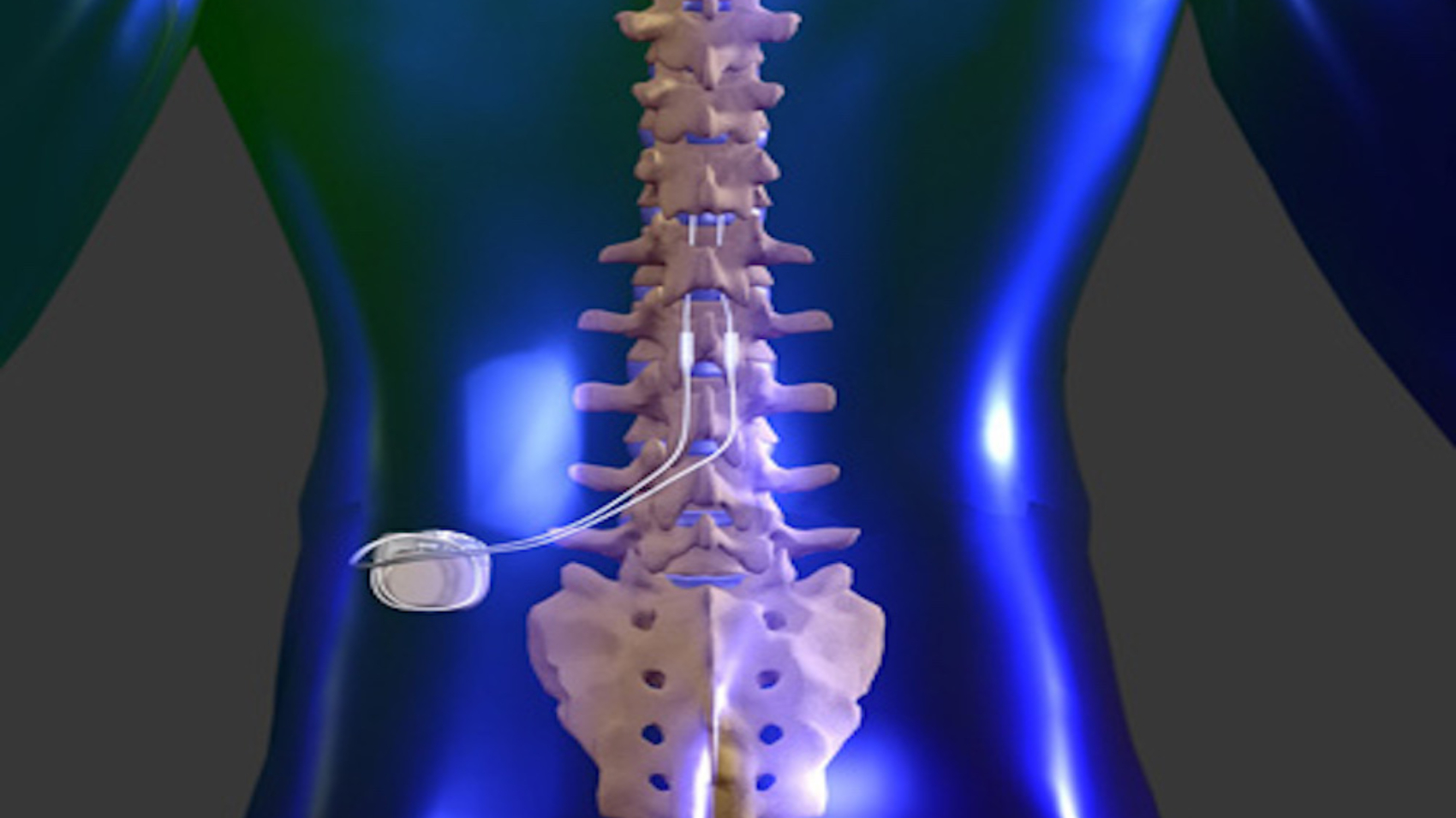 trial_spinal_cord_test